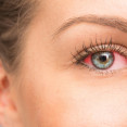 Aké sú príčiny prasknutej žilky v oku? Môže to byť vážne?